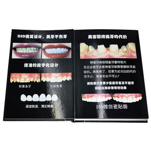 Catálogo de Carillas Dentales de Porcelana: Demostración del Proceso de Colocación de Carillas Dentales de Porcelana, Exhibición de Efectos, Calidad y - Product Image 2