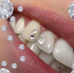 Joyería Dental Estilo 2025, Grillz de Dientes de Tiburón para Hombres y Mujeres, Removible, Se Pega con Broche - Product Image 1