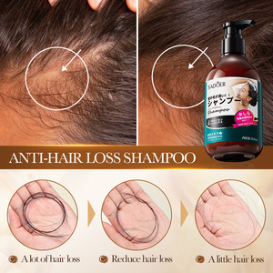 Shampoo <span class=keywords><strong>anti</strong></span>-frisottis de haute qualité 300 ml - Mousse nettoyante antipelliculaire <span class=keywords><strong>anti</strong></span>-chute de cheveux - Product Image 5