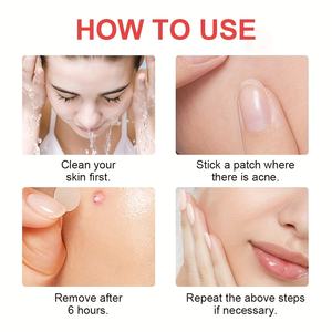 Onzichtbare Hydrocolloïde Acne Patches Dag Dragen Make-Up Vriendelijke Acne <span class=keywords><strong>Cure</strong></span> Patches Geavanceerde Formule Snelle Resultaten 'S Nachts - Product Image 6