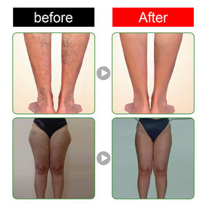 Herbes détox pied patch Detox Slim Relax pied Patch nettoyage en profondeur déshumidification naturelle réparation minceur pied patch - Product Image 5