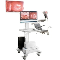 Colposcope vidéo numérique à double écran avec quatre modes d'imagerie pour l'examen professionnel en clinique gynécologique
