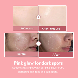 Siero Viso Marchio Privato con PDRN da DNA di Salmone, Peptidi e Niacinamide per Skincare Coreana Effetto Glow Anti-<span class=keywords><strong>Età</strong></span> e Rassodante - Product Image 5