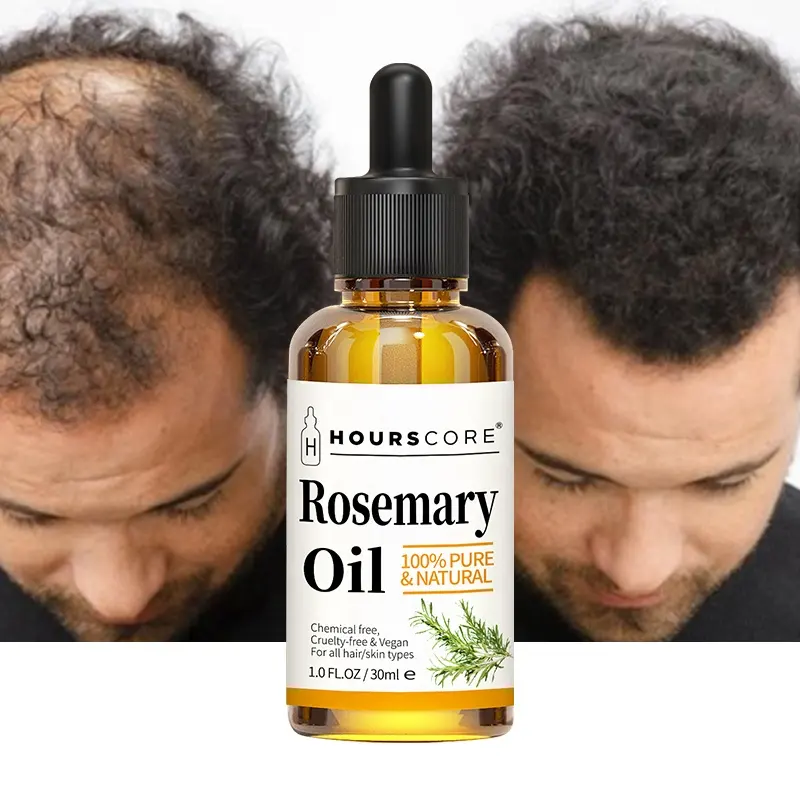 100% huiles essentielles de ricin bio naturelles de marque privée hommes femmes soin du cuir chevelu sérum traitement des cheveux croissance huile de romarin
