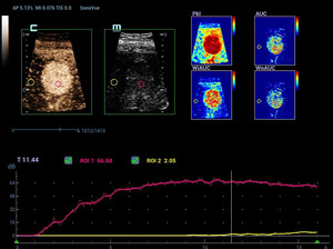 Appareil d'échographie sur chariot Mindray Resona R9 pour usage vétérinaire et système Doppler couleur, scanner d'échographie pour applications cliniques - Product Image 5