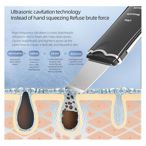 Alat Perawatan Kulit Wajah Profesional Elektrik Ultrasonik, Spatula Pengelupas Kulit, Perangkat Perawatan Kulit, Pembersihan Mendalam - Product Image 6