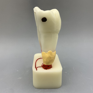 Модель стоматологической патологии кариес Пародонтит Демонстрация патологии полости рта Стоматологическое образование и обучение - Product Image 5