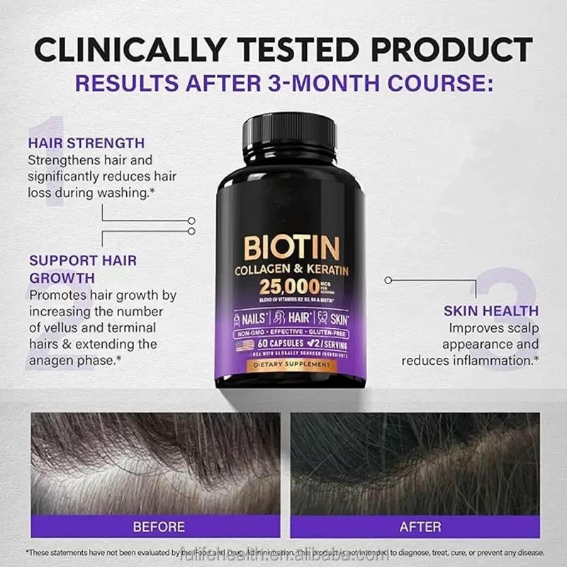 Biotin Collagen Keratin Collagen Capsules Skin Whitening Hair Nail ...
