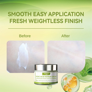 Crema Facial Antienvejecimiento con Niacinamida, Ácido Kójico y Colágeno Hidrolizado para Aclarar Manchas Oscuras, Eliminar <span class=keywords><strong>Melasma</strong></span> e Iluminar la Piel - Product Image 4