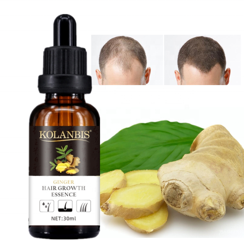 Low MOQ Private Label Ginger Hair Growth Essence Hair Loss Products Natural Organic Hair Oil OEM ODM Logo