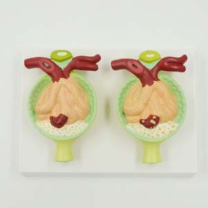 KyrenMed Modèle de protéinurie humaine élargie Grossissement Modèle de rein Corpuscule rénal Anatomie de l'<span class=keywords><strong>hypertension</strong></span> urologique Glomérulaire - Product Image 4