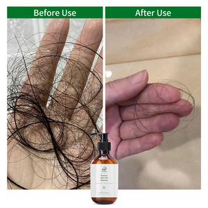 Shampooing Bio <span class=keywords><strong>Anti</strong></span>-<span class=keywords><strong>Chute</strong></span> Fortifiant les Racines des <span class=keywords><strong>Cheveux</strong></span> Marque Blanche 300ml Volumisant et Sans Silicone pour Hommes et Femmes - Product Image 3