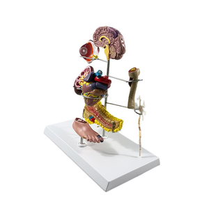 Modelo Anatómico de Diabetes de 8 Partes para la Enseñanza y Formación en Endocrinología - Product Image 5