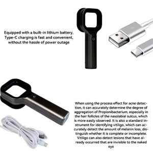 CE-zugelassener tragbarer Dermoskop Medical Veterinary Woods Lamp Skin Analyzer für den Vitiligo Psoriasis-Test - Product Image 4