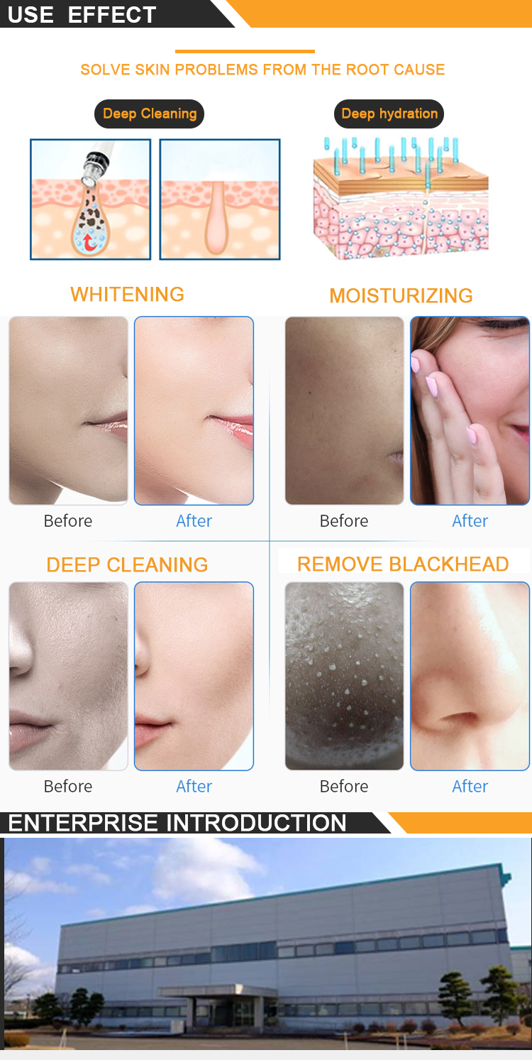 2022 new design first generation 6 In 1 H2o2 Small Bubble Facial Machine Oxygen Jet Peel Facial