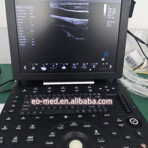 Appareil d'échographie cardiaque EO-C50, scanner d'échographie Doppler couleur portable, appareil de diagnostic ultrasonore avec batterie intégrée - Product Image 5