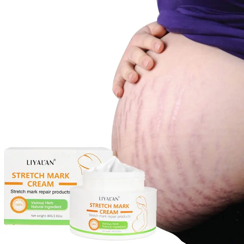 Best 80g Body Care Maternity Strech Marks Cream Removal Pregnancy Scar Repair Stretch Mark Cream