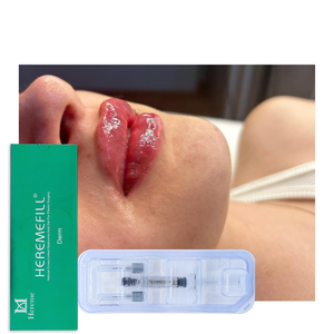 Hereme Lip Filler 2ml, Inyección <span class=keywords><strong>de</strong></span> Ácido Hialurónico para Aumentar el Volumen <span class=keywords><strong>de</strong></span> los <span class=keywords><strong>Labios</strong></span> y Realzar el Color Rojo, <span class=keywords><strong>Precio</strong></span> al por Mayor <span class=keywords><strong>con</strong></span> Certificación ISO y CE - Product Image 2