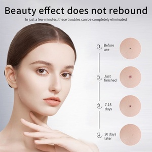 2 Agujas para Diferentes Necesidades, 15 Niveles de Ajuste Inteligente, Lápiz Escáner de Manchas de Belleza, Eliminación Profesional de Lunares - Product Image 4