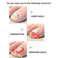 Patch de Correction d'Ongles Professionnel Portable Auto-Adhésif Sans Colle pour Soins des Pieds, Outils de Pédicure, Réduit la Douleur et la Pression, Boîte à Ongles