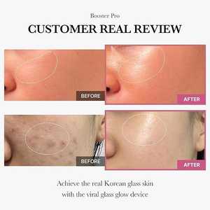 MEDICUBE AGE-R BOOSTER PRO Appareil de beauté coréen pour le visage, dispositif de lifting pour lutter contre le vieillissement et raffermir la peau, vente en gros - Product Image 2