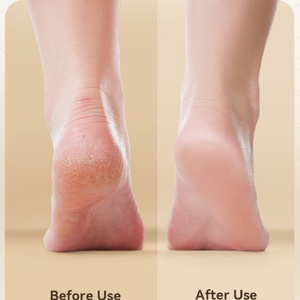 New <b>Electric</b> Feet Callus Removers Rechargeable 1300mAh Portable Electronic Foot File Pedicure Tools, <b>Electric</b> Callus Remover <b>Kit</b> - Product Image 6
