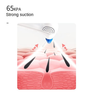 Nettoyeur de pores électrique USB à main, aspiration 50-65KPA, extracteur de points noirs, compresse chaude/froide pour ouvrir les pores, resserrer la peau - Product Image 3