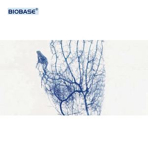 BIOBASE mesin pencari Nadi inframerah, pendeteksi pencari Nadi inframerah portabel sistem analisis darah untuk Lab - Product Image 2