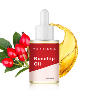 น้ำมันโรสฮิปสกัดเย็น 100% บริสุทธิ์จากธรรมชาติ น้ำมันเมล็ดโรสฮิป บำรุงผิวหน้า ต่อต้านริ้วรอย ช่วยให้ผิวกระจ่างใส ชุ่มชื้น น้ำมันบำรุงผิว - Product Image 1
