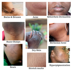 สบู่สมุนไพรขมิ้นทำมือ ออร์แกนิคธรรมชาติ แบรนด์ส่วนตัว ช่วยลดสิว ฝ้า กระ จุดด่างดำ - Product Image 6