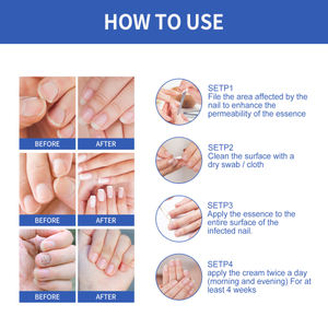 OUHOE Nail Repair Essence de soin des <span class=keywords><strong>ongles</strong></span> gris doux nettoyant et éclaircissant - Product Image 5