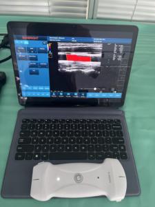 SUN-D7 128 éléments diagnostic vétérinaire sonde sans fil à ultrasons Doppler couleur - Product Image 4