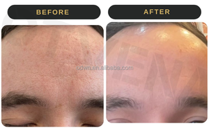 Chăm Sóc Da Mặt Tốt Nhất Vitamin E Kem Dưỡng Ẩm Làm Trắng Da Chống Lão Hóa Kem Mặt - Product Image 2