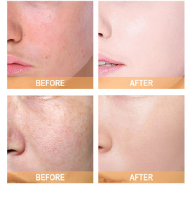 AHA Glycolic Acid Anti-Wrinkle Luxury Facial Toning <b>Solution</b> Exfoliating Moisturizing Face Toner Pore Refining Skin Care 240ml - Product Image 2