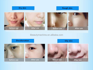 Oferta Especial: Mini Bolígrafo de Oxígeno y CO2, Cápsulas de Oxigenación Recargables, Equipo Facial para Reafirmar la Piel con Oxígeno - Product Image 4