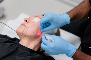 Appareil d'<span class=keywords><strong>injection</strong></span> pour <span class=keywords><strong>lipolyse</strong></span> corporelle complète, élimination du <span class=keywords><strong>double</strong></span> <span class=keywords><strong>menton</strong></span>, Endolaser Lipo Elyon, liposuccion BBL Laser 980nm 1470nm, dissolution des graisses - Product Image 3