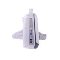 Ecógrafo Doppler Color Portátil con Pantalla LCD de 15 Pulgadas, 5 Modos de Imagen, 8 Sondas, 500GB DICOM, para Abdomen, Cardiaco, Obstetricia/Ginecología y Clínica