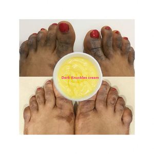 Crème à la vitamine <span class=keywords><strong>pour</strong></span> le visage et le corps, blanchiment extrême, <span class=keywords><strong>anti</strong></span>-<span class=keywords><strong>taches</strong></span> brunes, rétinol, ridules, genoux et coudes, tous types de peau, professionnelle - Product Image 1
