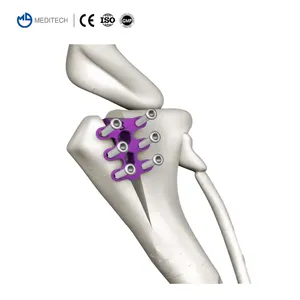 סט מוצרים אורטופדיים וטרינריים של MEDITECH Vet Tta כלוב שתל מהיר כלוב