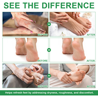 SEFUDUN contrôle les odeurs de pieds désinfectant antimicrobien pour les pieds spray désodorisant antifongique pour les pieds avec de l'huile d'arbre à thé