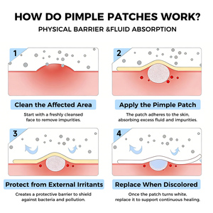 Cerotti Idrocolloidali per Acne OEM con Etichetta Privata, Patch Invisibili e Impermeabili per Brufoli, per Uso Giorno e Notte - Product Image 2