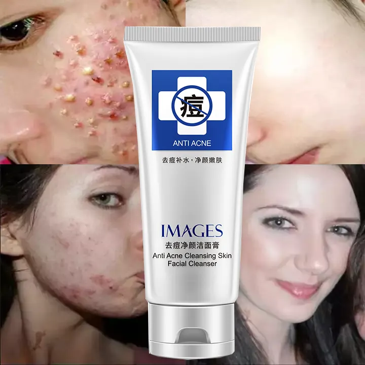 OEM छवियों अन्य त्वचा देखभाल उत्पादों (नई) मुँहासे क्रीम दाना पैच अंधेरे स्थान पदच्युत चेहरे की देखभाल चेहरे क्रीम लोशन