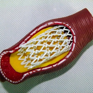 Modelo Anatómico de <span class=keywords><strong>Stent</strong></span> Vascular Humano SMM3192 (PVC) para Educación en Ciencias Médicas - Arteria Coronaria - Product Image 4