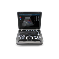Système d'échographie diagnostique vétérinaire couleur Doppler haute résolution Antonmed CMS1700C en acier inoxydable, garantie 1 an
