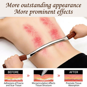 304 Edelstahl Schab- und Massagebrett für Ganzkörperbehandlung. Holzgriff. Großes <span class=keywords><strong>M</strong></span>-förmiges Messer. Faszienmesser. - Product Image 2