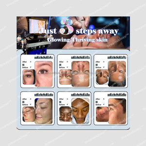 Máquina de <span class=keywords><strong>Limpieza</strong></span> Profunda <span class=keywords><strong>Hydrafacial</strong></span> 2025, Dreamskineo Serum Booster, Máquina de Cuidado de la Piel, Equipo de Spa para la Piel, Solución Hydra Beauty Booster - Product Image 2
