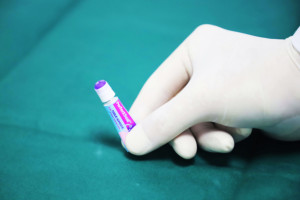 Pegamento adhesivo quirúrgico para <span class=keywords><strong>heridas</strong></span>, adhesivo para curar <span class=keywords><strong>heridas</strong></span>, certificado CE - Product Image 6