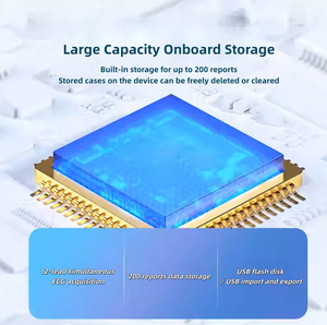 Électrocardiographe portable à écran tactile 12 pistes ECG, moniteur ECG 12 canaux, appareil d'échocardiographie - Product Image 6