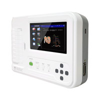 CONTEC ECG600G Elektrokardiograf Medis Portabel Mesin EKG Kardiak