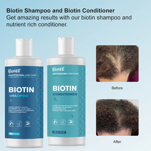 迷迭香薄荷强化洗发水注入生物素，清洁并有助于强化脆弱的头发 - Product Image 3